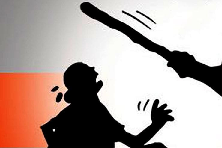 चिर्पट प्रहार गरी श्रीमतीको हत्या